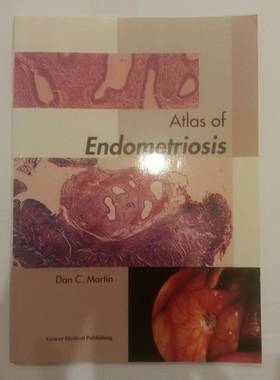 Atlas of Endometriosis