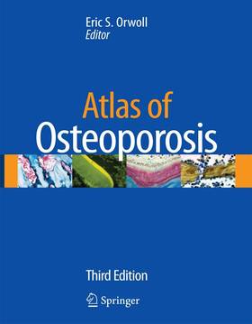 Atlas of Osteoporosis's front cover